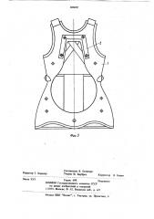 Способ исправления воронкообразнойдеформации грудной клетки и устрой-ctbo для его осуществления (патент 806005)