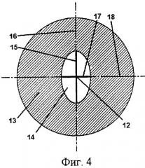 Способ хирургической коррекции пресбиопии в сочетании со сложным гиперметропическим астигматизмом (патент 2314075)