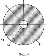Способ хирургической коррекции пресбиопии в сочетании со сферической гиперметропией (патент 2314074)