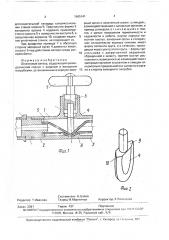 Шланговый затвор (патент 1665141)
