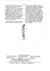 Устройство для уплотнения хирургических швов при наложении круговых анастомозов на полые органы сшивающими аппаратами (патент 1113107)