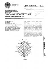 Шайба к винту для остеосинтеза (патент 1584926)