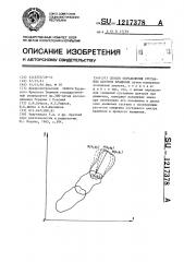 Способ определения суставных центров вращения (патент 1217378)