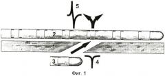 Способ радиочастотной катетерной аблации левосторонних дополнительных путей атриовентрикулярного проведения (патент 2438569)