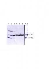 Способ дифференциации токсигенных и атоксигенных штаммов холерных вибрионов 01 серогруппы по ингибирующей активности (патент 2596401)