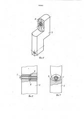 Устройство для остеосинтеза надмыщелковой части голени (патент 982680)