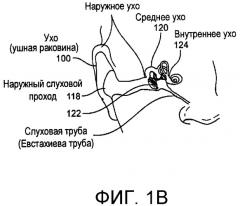 Системы и способы анестезирования ткани уха (патент 2503469)