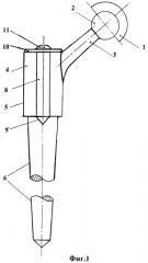 Эндопротез тазобедренного сустава (патент 2391943)