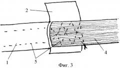 Способ ксенопластики сухожилий сгибателей пальцев кисти (патент 2440057)