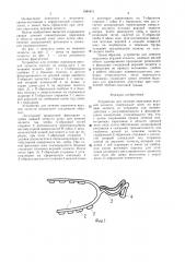 Устройство для лечения переломов верхней челюсти (патент 1544411)