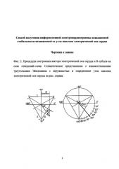 Способ получения информативной электрокардиограммы повышенной стабильности независимой от угла наклона электрической оси сердца (патент 2580976)