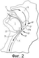 Способы и устройства для формирования вспомогательного дыхательного пути для лечения обструктивного апноэ во сне (патент 2497485)