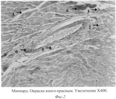 Способ моделирования экспериментальной амилоидной кардиопатии у крыс (патент 2556571)