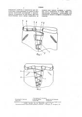 Застежка для брюк (патент 1556643)