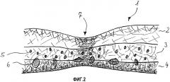 Абсорбирующая структура (патент 2567722)