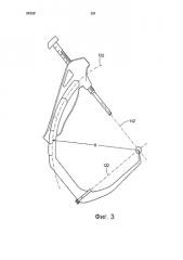 Хирургическое устройство нацеливания (патент 2592245)