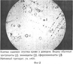 Способ определения тяжести состояния больного и возможной причины патологического процесса (патент 2480754)