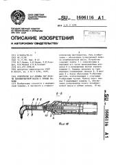 Устройство и.г.мухина для подачи пломбировочной массы в зубные каналы (патент 1606116)