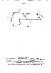Устройство для лечения импотенции (патент 1688865)