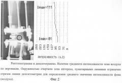 Способ фотоденситометрии рентгенограмм или их оцифрованных изображений (патент 2281030)