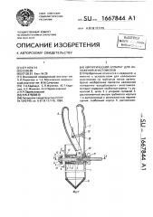 Хирургический аппарат для наложения анастомозов (патент 1667844)