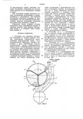 Установка для отделения посторонних включений из пульпы пищевых отходов (патент 1577837)