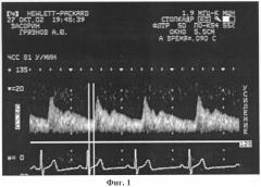 Способ измерения скорости распространения пульсовой волны по мозговым артериям (патент 2269935)