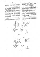 Способ пересадки тонкой кишки (патент 1286165)