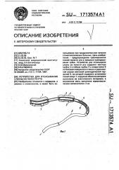 Устройство для отсасывания слюны из полости рта (патент 1713574)