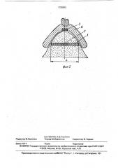 Устройство для фиксации съемных зубных протезов с магнитом (патент 1725873)