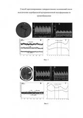 Способ прогнозирования геморрагических осложнений после выключения церебральной артериовенозной мальформации из кровообращения (патент 2598758)