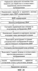 Терапевтическая система на основе сфокусированного ультразвука (патент 2366475)