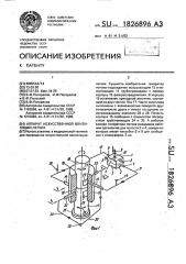 Аппарат искусственной вентиляции легких (патент 1826896)