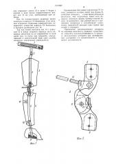 Ортопедический аппарат на нижнюю конечность (патент 1215692)