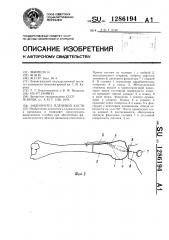 Эндопротез плечевой кости (патент 1286194)