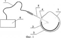 Способ освещения глазного дна (патент 2360594)