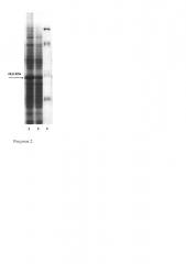 Штамм бактерий escherichia coli bl21 (de3) bpsomp39 - продуцент рекомбинантной плазмидной днк pbpsomp39, несущей полноразмерную последовательность гена поверхностного протеина omp39 burkholderia pseudomallei (патент 2662957)