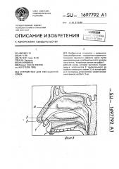 Устройство для уменьшения храпа (патент 1697792)