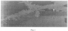 Способ дифференциальной диагностики простой и быстрорастущей миомы матки с нормальным строением эндометрия (патент 2554824)
