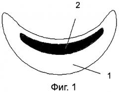 Протез челюсти и способ его изготовления (патент 2530717)