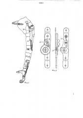 Биоэлектрический ортопедический аппарат на верхнюю конечность (патент 384520)