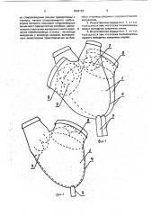 Искусственное сердце (патент 1803133)