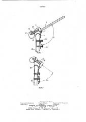 Устройство для остеотомии проксимального отдела бедра (патент 1097303)