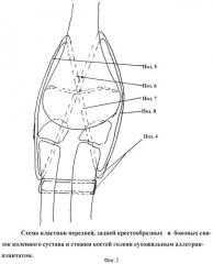 Способ лечения врожденного диастаза (расщепления) коленного сустава у детей (патент 2407474)