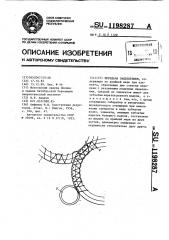 Передача зацеплением (патент 1198287)