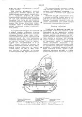 Устройство для фиксации датчика эхокардиографа (патент 1498462)