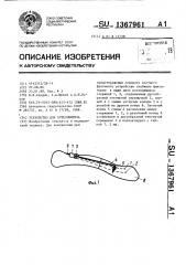 Устройство для остеосинтеза (патент 1367961)