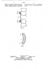 Устройство для лечения привычного вывиха в височнонижнечелюстном суставе (патент 1149957)