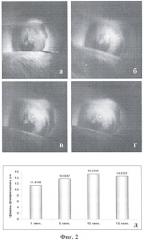 Способ флюоресцентной диагностики в ходе фотодинамической терапии глазных заболеваний (патент 2411901)