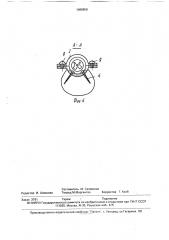 Способ лечения дефектов спинного мозга (патент 1688858)
